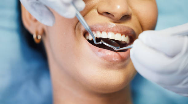 Best Dentist for Severe Toothache  in Listoga, CA